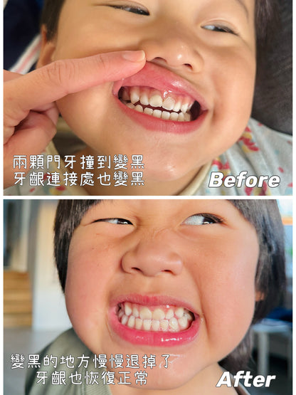 GC Tooth Mousse牙齒修復慕斯